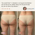 Freia™ | Din sommar. Dina villkor